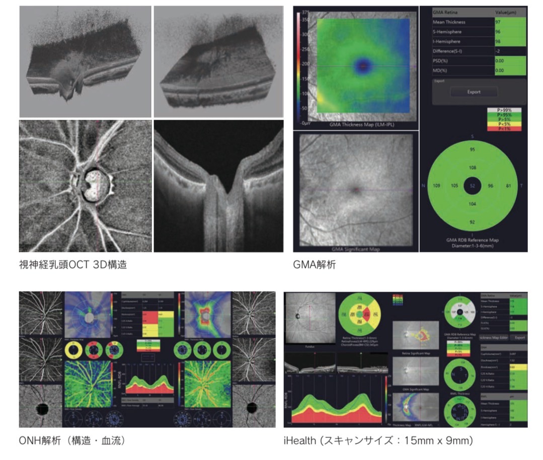 日本初導入！最新OCT「Yalkaid OCT」のご紹介 – 医療法人 森眼科内科医院